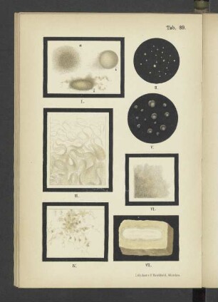 Tab. 39 Bacillus anthracis
