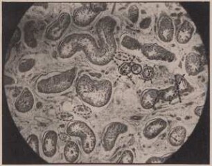 Abbildung eines Mikrophotogramms von einem Hoden