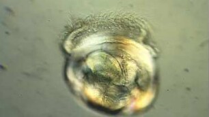 Bivalvia veliger larva 1 Helgoland 2012