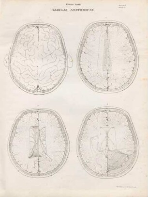 Cerebrum a summo descriptum/ Corporis callosi facies superior/ Corporis callosi et fornicis facies superior/ Colliculi et ventriculi eerebri (Lineartafel)