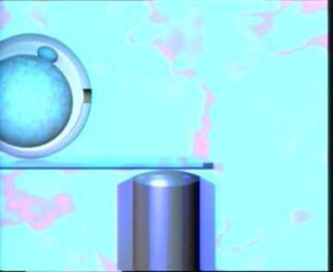 Laser Microbeam and Optical Tweezers - Micromanipulation of Gametes and Embryos
