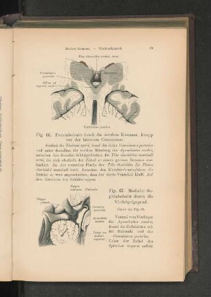 Fig. 66. Frontalschnitt durch die mittlere Kammer, knapp vor der hinteren Commissur.