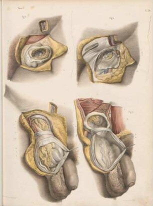 Anatomie von Hernien