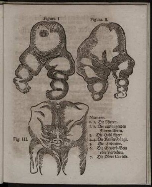 Figura I. - Fig. III.