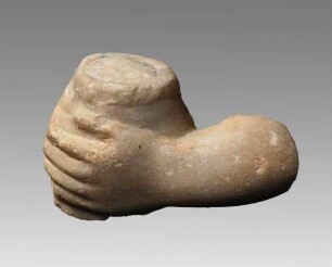 Linker Arm mit Gefäß