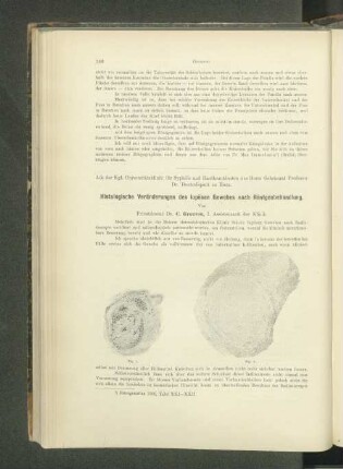 Histologische Veränderungen des lupösen Gewebes nach Röntgenbehandlung.