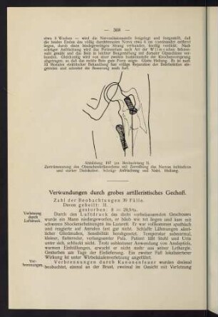 368-374, XII. Verwundungen durch grobes artilleristisches Geschoss.
