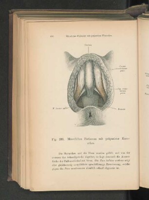 Fig. 393. Männliches Perineum mit präparierter Harnröhre.