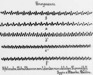 Köhlersche Schallkurven, Tenorposaune : Technikgeschichte | Physik | Akustik | Schallschwingungen und ihre photographische Wiedergabe