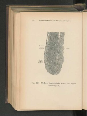 Fig. 441. Medianer Sagittalschnitt durch das Septum urethrovaginale.