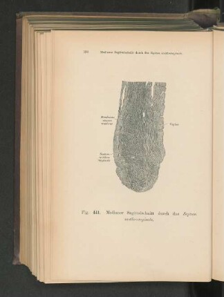 Fig. 441. Medianer Sagittalschnitt durch das Septum urethrovaginale.