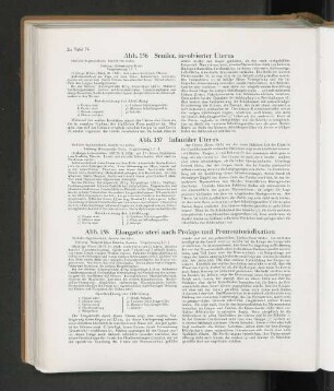 Abb. 156 Seniler, involvierter Uterus