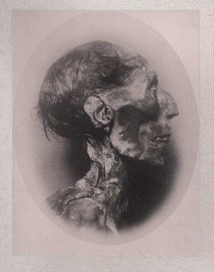 Mumie Ramses II., Kopf