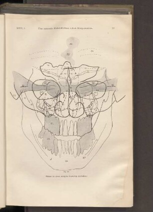Fig. 20. Skizze zu einer occipito-frontalen Aufnahme.