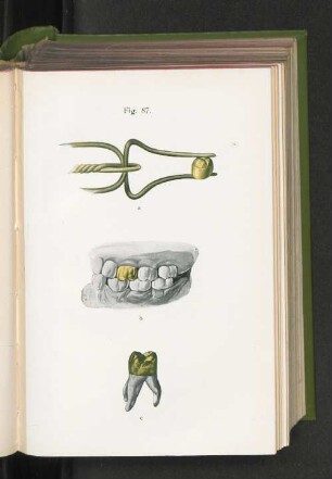 Fig. 87.
