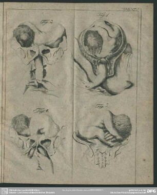 Tab. XIV