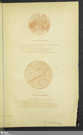 VI. Seniles Rückenmark