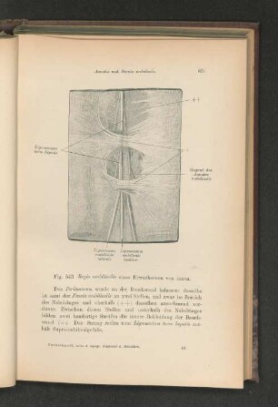 Fig. 543. Regio umbilicalis eines Erwachsenen von innen.
