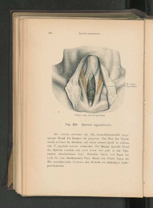 Fig. 210. Spatium suprasternale.