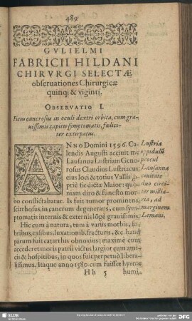 Gulielmi Fabricii Hildani Chirurgi Selectae observationes Chirurgicae quinq[ue] & viginti