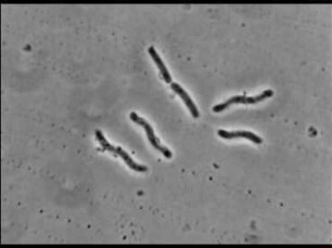 Bdellovibrio bacteriovorus (Pseudomonadaceae) - Parasitischer Befall und Lysis von Spirillum serpens