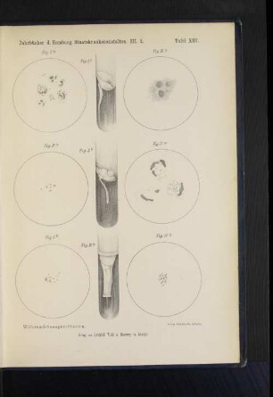 Tafel XIII. Wilbrand-Saenger-Staelin.