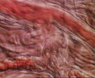 Entstehung von Thrombozyten-Thromben in vivo