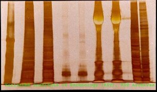 Desoxyribonukleinsäure (DNA)-Gel des Instituts für Genetik (IGEN)