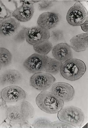 Chromosomen einer Lilie, ca. 1000-fach vergrößert, Mikrofotografie