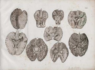 Ansicht des großen Hirns von Oben