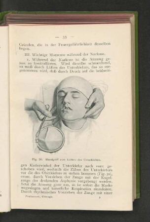 III. Wichtige Momente während der Narkose.