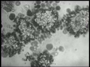 Proteus - L-Phase durch Penicillineinwirkung