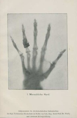 I. Menschliche Hand
