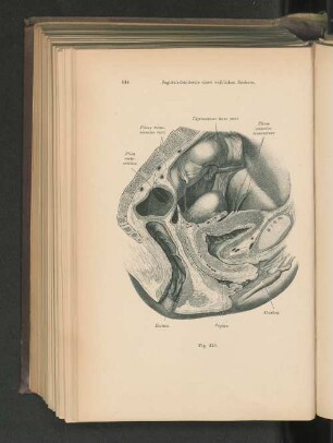 Fig. 449. Sagittalschnitt eines weiblichen Beckens.