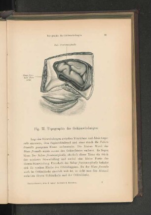 Fig. 77. Topographie und Gehirnwindungen.
