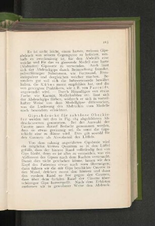 Gipsabdrücke für zahnlose Oberkiefer.
