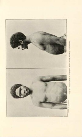 Plate LXI. Negrito man of Zabales, mixed blood, showing skin disease