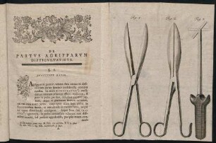 1-36, De Partus Agripparum Difficultatibus