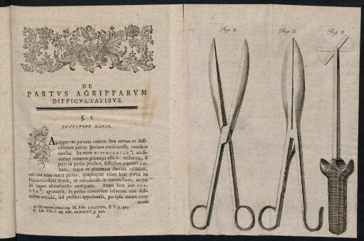 1-36, De Partus Agripparum Difficultatibus