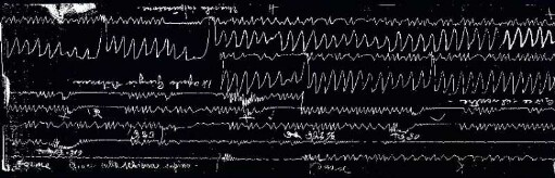 [Graphical recordings]