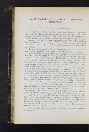 Fig. 98. Inguinalgegend, erste Schicht. Oberflächliche Lymphdrüsen.