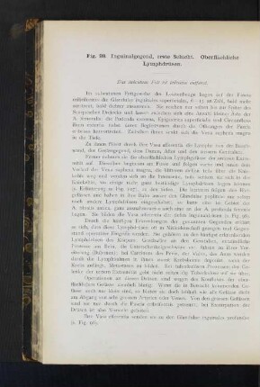 Fig. 98. Inguinalgegend, erste Schicht. Oberflächliche Lymphdrüsen.