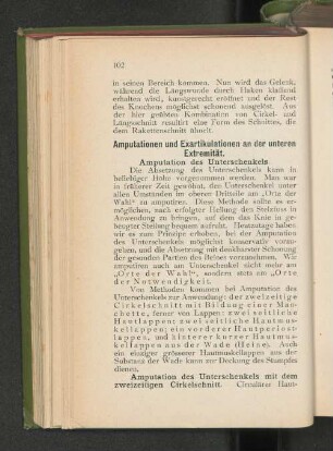 Amputation des Unterschenkels.