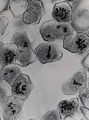 Chromosomen einer Lilie, ca. 1000-fach vergrößert, Mikrofotografie