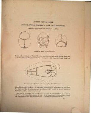 Crania Britannica : Delineations and descriptions of the skulls of the aboriginal and early inhabitants of the British Islands: with notices of their other remains. By Joseph Barnard Davis and John Thurnam, 2