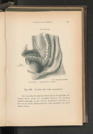 Fig. 339. Varietät des Colon sigmoideum.
