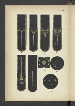 Tab. 49 Vibrio cholerae