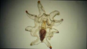Bipinnaria larva, undet., Lanzarote 2022