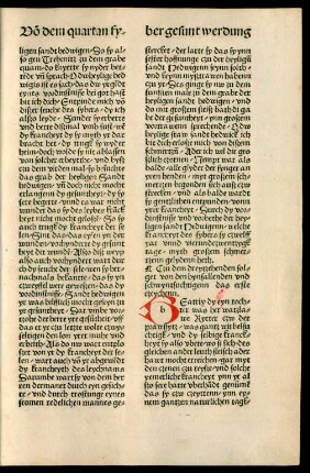 Czu dem dreytzehenden folget von den hynfallenden und schwyntsuchtigenn ...