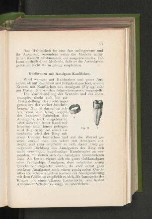 Goldkronen mit Amalgam-Kauflächen.